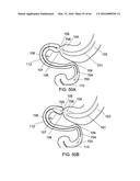 DELIVERY DEVICES AND METHODS FOR GASTROINTESTINAL IMPLANTS diagram and image