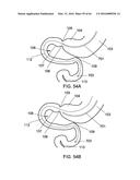 DELIVERY DEVICES AND METHODS FOR GASTROINTESTINAL IMPLANTS diagram and image