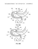 DELIVERY DEVICES AND METHODS FOR GASTROINTESTINAL IMPLANTS diagram and image