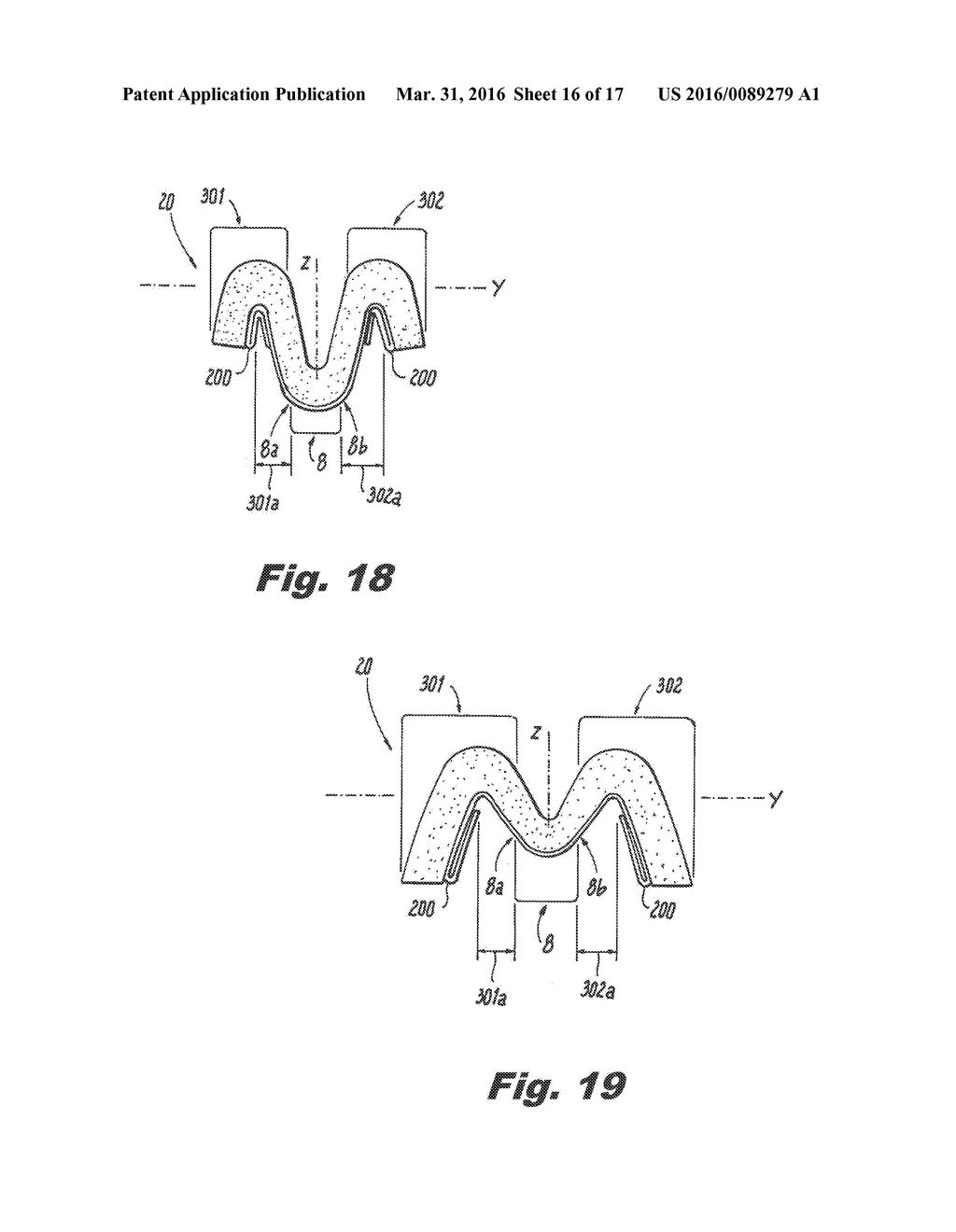 ABSORBENT ARTICLE DEMONSTRATING CONTROLLED DEFORMATION AND LONGITUDINAL     FLUID DISTRIBUTION - diagram, schematic, and image 17