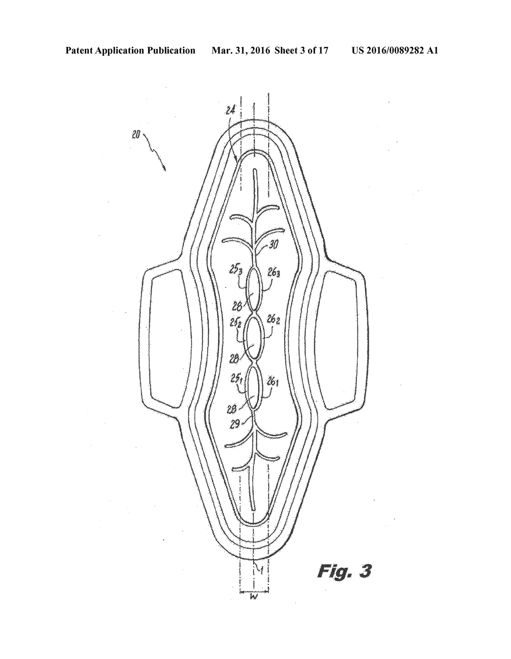 ABSORBENT ARTICLE DEMONSTRATING CONTROLLED DEFORMATION AND LONGITUDINAL     FLUID DISTRIBUTION - diagram, schematic, and image 04