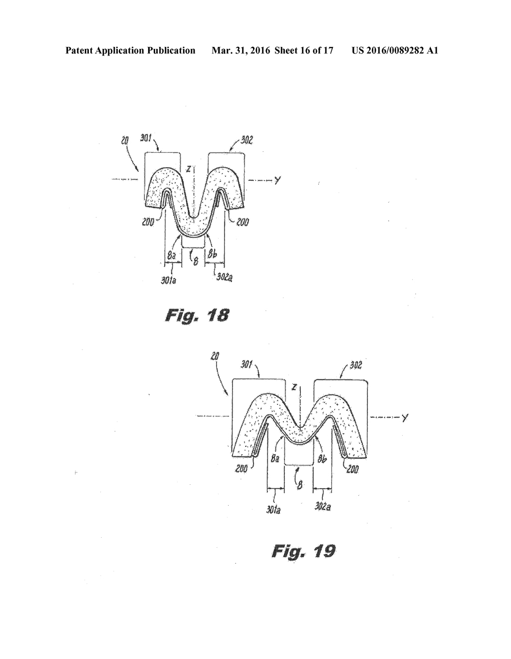 ABSORBENT ARTICLE DEMONSTRATING CONTROLLED DEFORMATION AND LONGITUDINAL     FLUID DISTRIBUTION - diagram, schematic, and image 17