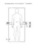 PATIENT TRANSFER ASSEMBLY diagram and image