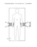 PATIENT TRANSFER ASSEMBLY diagram and image