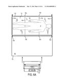 PATIENT TRANSFER ASSEMBLY diagram and image