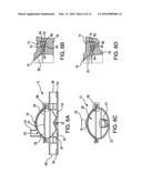 Pressure Output Device For Extracorporeal Hemodialysis Machine diagram and image