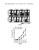 METHODS OF PROGNOSTICALLY CLASSIFYING AND TREATING GLANDULAR CANCERS diagram and image