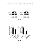 METHODS OF PROGNOSTICALLY CLASSIFYING AND TREATING GLANDULAR CANCERS diagram and image