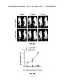 METHODS OF PROGNOSTICALLY CLASSIFYING AND TREATING GLANDULAR CANCERS diagram and image