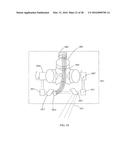 HIGH POWER LASER ENERGY DISTRIBUTION PATTERNS, APPARATUS AND METHODS FOR     CREATING WELLS diagram and image