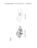 Method and a System for Determining at Least One Forecasted Air Quality     Health Effect Caused in a Determined Geographical Area by at Least One     Air Pollutant diagram and image