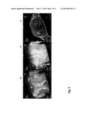 Patient-Specific Estimation of Specific Absorption Rate diagram and image