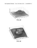 METHOD, SYSTEM AND COMPUTER PROGRAM PRODUCT FOR IMPROVING THE QUALITY OF     AN IMAGE diagram and image