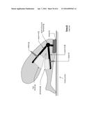 LEG PROTECTION SYSTEM diagram and image