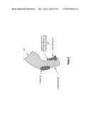 KNEE PROTECTION SYSTEM diagram and image