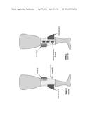 KNEE PROTECTION SYSTEM diagram and image