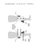 KNEE PROTECTION SYSTEM diagram and image