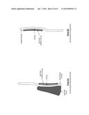 KNEE PROTECTION SYSTEM diagram and image