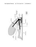 KNEE PROTECTION SYSTEM diagram and image