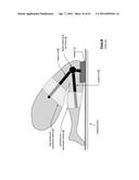 KNEE PROTECTION SYSTEM diagram and image