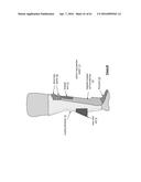 KNEE PROTECTION SYSTEM diagram and image