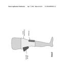 KNEE PROTECTION SYSTEM diagram and image