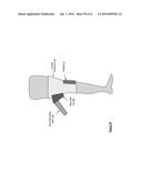 KNEE PROTECTION SYSTEM diagram and image