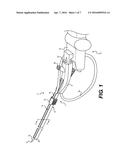 ATTACHMENT DEVICE FOR A URETEROSCOPE diagram and image