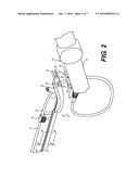 ATTACHMENT DEVICE FOR A URETEROSCOPE diagram and image