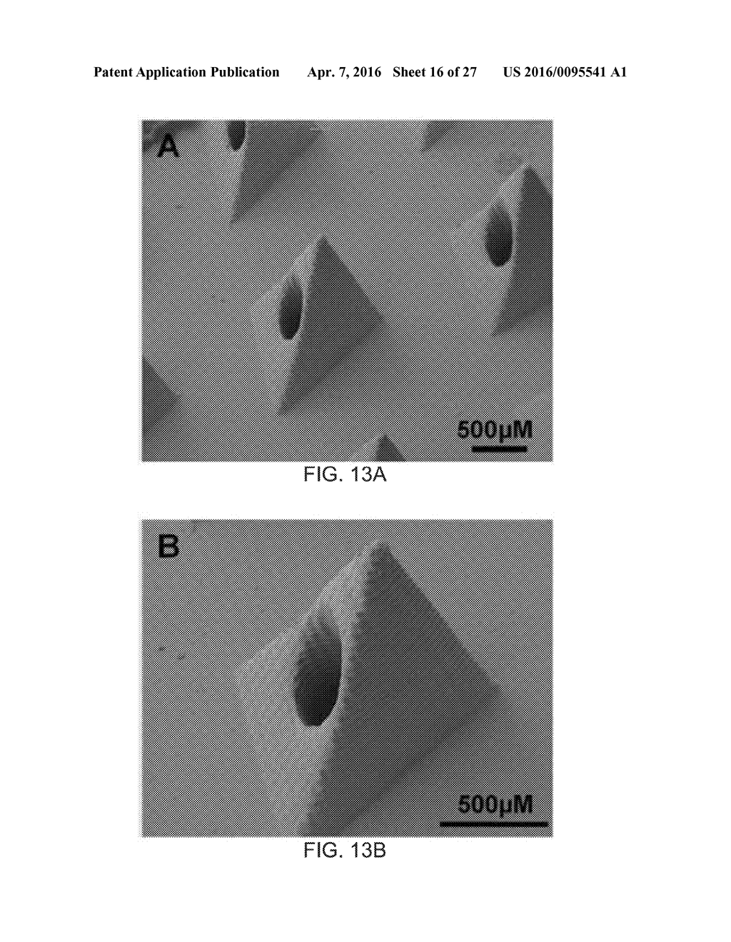 MICRONEEDLE ARRAYS FOR BIOSENSING AND DRUG DELIVERY - diagram, schematic, and image 17