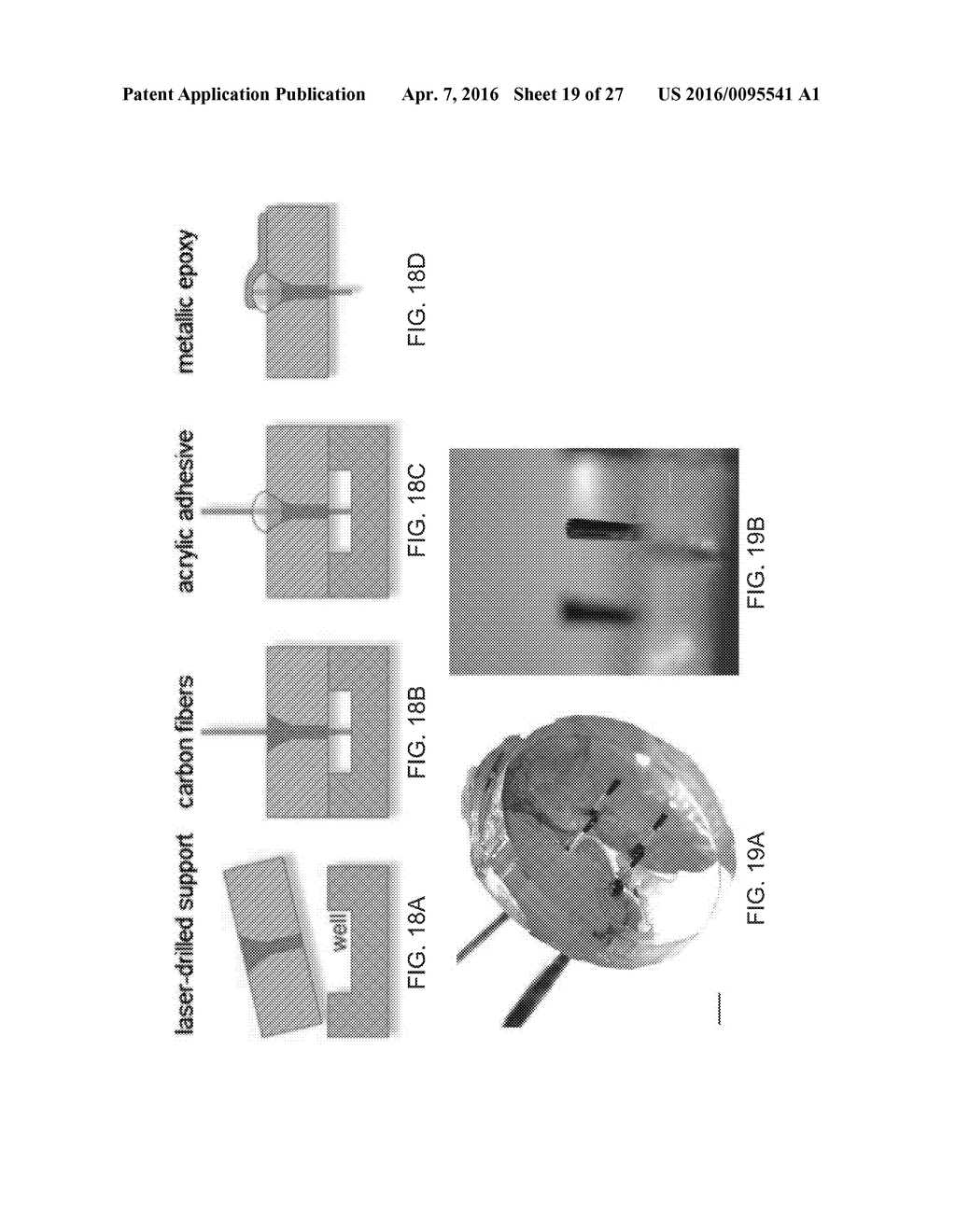 MICRONEEDLE ARRAYS FOR BIOSENSING AND DRUG DELIVERY - diagram, schematic, and image 20