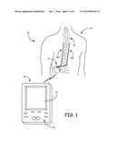 AUTOMATED CALIBRATION OF POSTURE STATE CLASSIFICATION FOR A MEDICAL DEVICE diagram and image