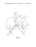 AUTOMATED CALIBRATION OF POSTURE STATE CLASSIFICATION FOR A MEDICAL DEVICE diagram and image