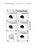 NON-INVASIVE RADIOFREQUENCY COIL FOR MAGNETIC RESONANCE IMAGING diagram and image