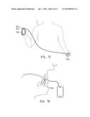 PERIPHERAL PHYSIOLOGY INSPECTION APPARATUS AND PERIPHERAL AUXILIARY     APPARATUS OF SMART PHONE diagram and image