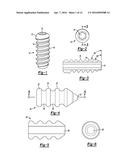 KNOTLESS GRAFT FIXATION ASSEMBLY diagram and image