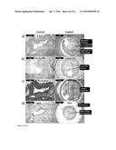 BIORESORBABLE BIOPOLYMER ANASTOMOSIS DEVICES diagram and image