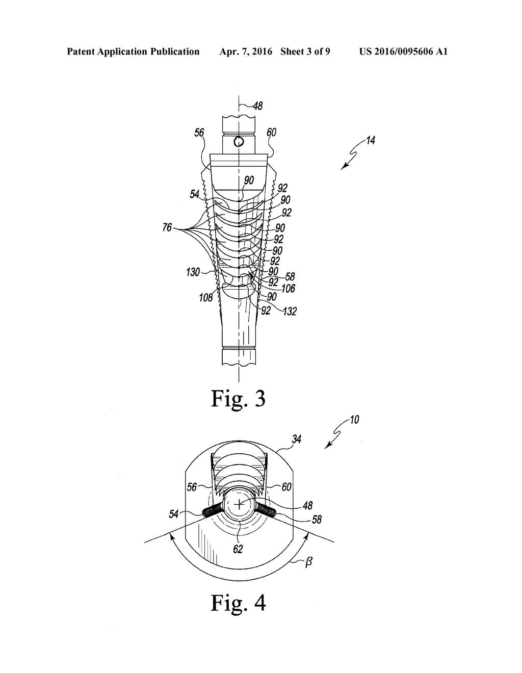 BROSTEOTOME AND METHOD OF USE - diagram, schematic, and image 04