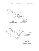 TIBIAL ARTHROPLASTY JIG diagram and image