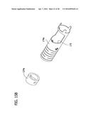 Tissue-Removing Catheter Including Screw Blade and Cutter Driveshaft diagram and image