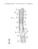 Tissue-Removing Catheter Including Screw Blade and Cutter Driveshaft diagram and image