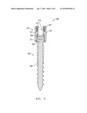 ROD AND ANCHOR SYSTEM AND METHOD FOR USING diagram and image