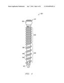 ROD AND ANCHOR SYSTEM AND METHOD FOR USING diagram and image