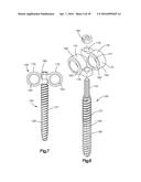 SPINAL STABILIZING AND GUIDING FIXATION SYSTEM diagram and image