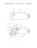 SPINAL STABILIZING AND GUIDING FIXATION SYSTEM diagram and image