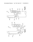 SPINAL STABILIZING AND GUIDING FIXATION SYSTEM diagram and image