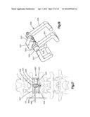 SPINAL STABILIZING AND GUIDING FIXATION SYSTEM diagram and image