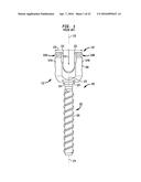 METHODS AND DEVICES FOR POLYAXIAL SCREW ALIGNMENT diagram and image