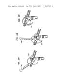 METHODS AND DEVICES FOR POLYAXIAL SCREW ALIGNMENT diagram and image