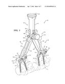 Osteotomy Instrument diagram and image